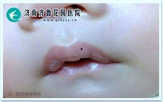 宝宝吃瓜之后嘴唇发黑,宝宝吃瓜后嘴唇发黑之谜揭秘