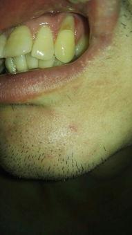 吃瓜牙齿感觉很凉,揭秘吃瓜牙齿的清凉奥秘